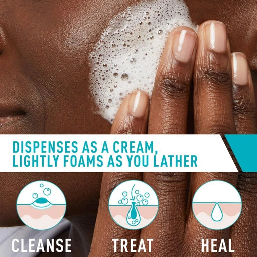 CeraVe Foaming Acne Cream Cleanser with 4% Benzoyl Peroxide - 5oz - Nan