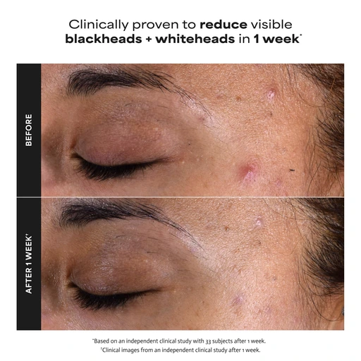 Paulas Choice SKIN PERFECTING 2% BHA Liquid Leave-On Exfoliant - Image 4