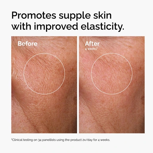 The Ordinary Hyaluronic Acid 2% + B5 (with Ceramides), Multi-Depth Hydration Serum for Plumper, Smoother Skin - Image 3
