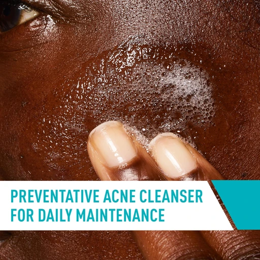 CeraVe Acne Control Cleanser, Face Wash with 2% Salicylic Acid, 16 oz - Image 4
