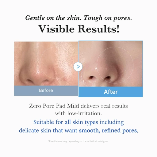 medicube Toner Pads Zero Pore Pad Mild 2.0 for Gentle Exfoliating - Image 5